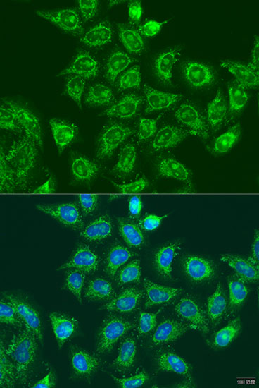 Anti-UBE2A Antibody (CAB12528)