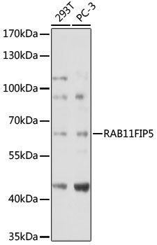 Anti-RAB11FIP5 Antibody (CAB18142)