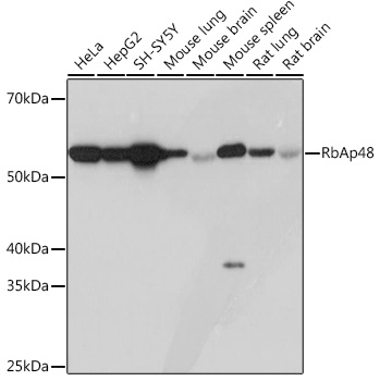 Anti-RbAp48 Antibody [KO Validated] (CAB3645)