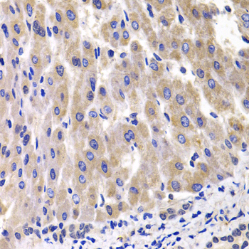 Anti-RPL14 Antibody (CAB6724)