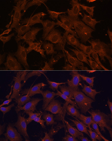 Anti-SQSTM1 Antibody (CAB11246)