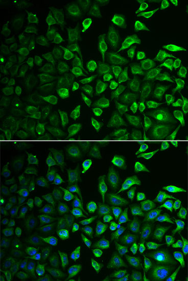 Anti-IMPA1 Antibody (CAB6381)