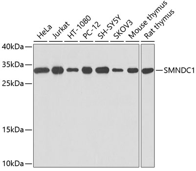 Anti-SMNDC1 Antibody (CAB0681)