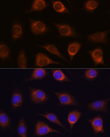 Anti-METTL7A Polyclonal Antibody (CAB8201)