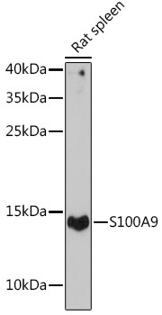 Anti-Protein S100-A9 Polyclonal Antibody (CAB9842)