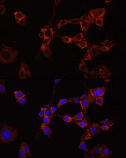 Anti-IGF1R Antibody (CAB0243)