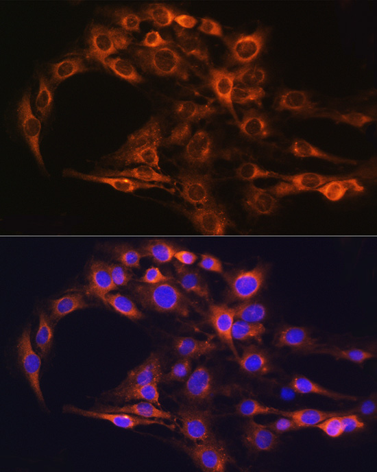 Anti-FCGRT Polyclonal Antibody (CAB8544)