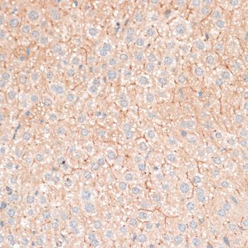 Anti-CDH18 Antibody (CAB14645)