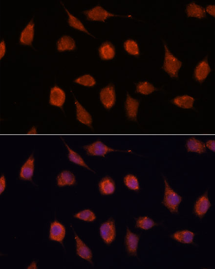 Anti-KCNAB2 Antibody (CAB16224)