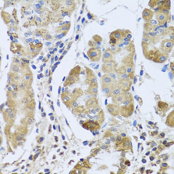 Anti-EFHC1 Polyclonal Antibody (CAB8002)