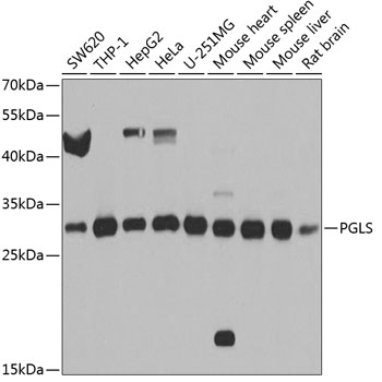 Anti-PGLS Polyclonal Antibody (CAB8366)