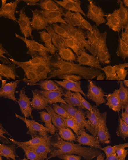 Anti-PEBP1 Antibody (CAB0578)