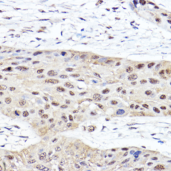 Anti-PSMB2 Antibody (CAB5483)