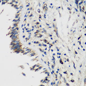 Anti-SMYD1 Antibody (CAB2340)