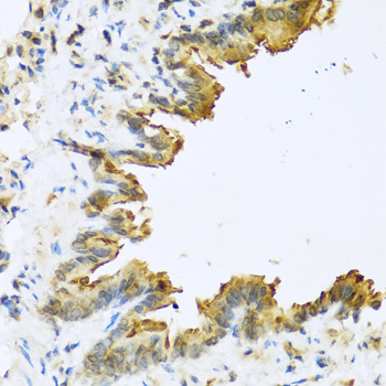 Anti-DEFB4A Antibody (CAB1643)