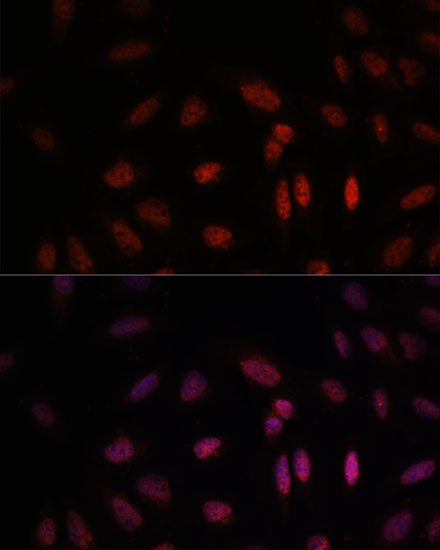 Anti-WDR18 Antibody (CAB15875)