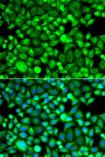 Anti-PSMB8 Antibody (CAB7340)