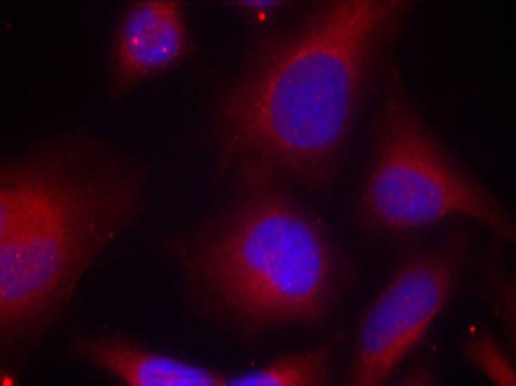 Anti-Phospho-MARCKS-S158 Antibody (CABP0402)