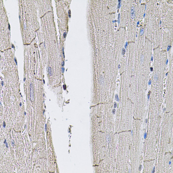 Anti-SLC2A3 Polyclonal Antibody (CAB8150)