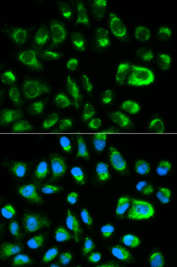 Anti-GAS2 Antibody (CAB1168)