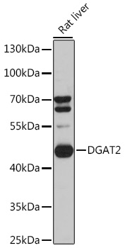 Anti-DGAT2 Antibody (CAB13891)