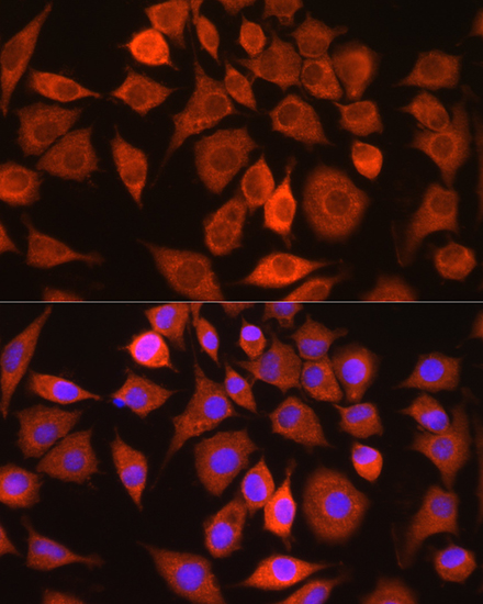 Anti-Bax Antibody (CAB7626)