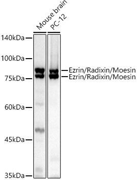 Western blot analysis of extracts of various cell lines, using Ezrin/Radixin/Moesin antibody at 1:1000 dilution. Secondary antibody: HRP Goat Anti-Rabbit IgG (H+L) at 1:10000 dilution. Lysates/proteins: 25ug per lane. Blocking buffer: 3% nonfat dry milk in TBST. Detection: ECL Basic Kit. Exposure time: 20s.