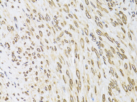 Anti-EMD Antibody (CAB13925)