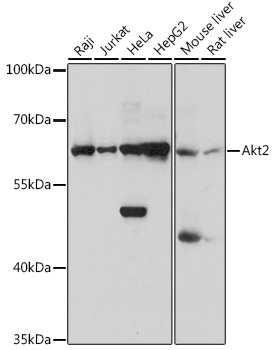 Anti-Akt2 Antibody (CAB1250)