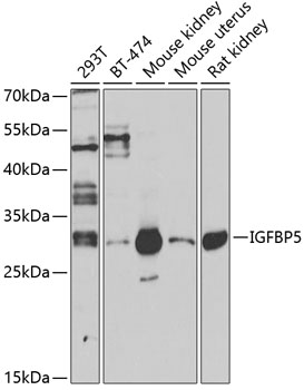 Anti-IGFBP5 Antibody (CAB12451)