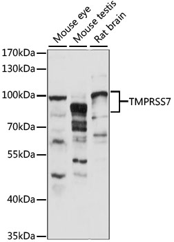 Anti-TMPRSS7 Antibody (CAB15225)