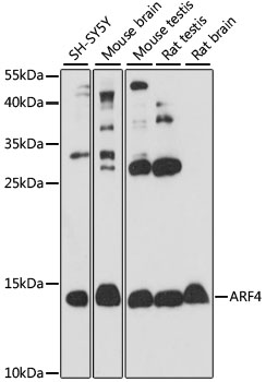 Anti-ARF4 Antibody (CAB7644)