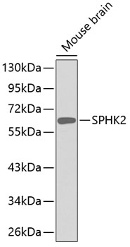 Anti-SPHK2 Antibody (CAB3204)