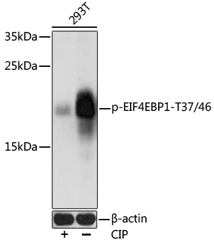 Anti-Phospho-EIF4EBP1-T37/46 Antibody (CABP0030)