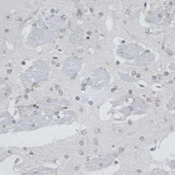 Anti-USP7 Antibody (CAB13565)