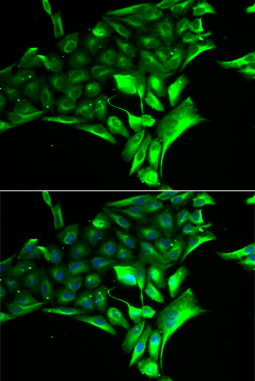 Anti-PYGB Antibody (CAB6402)