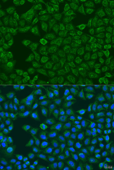 Anti-FMO5 Antibody (CAB7673)