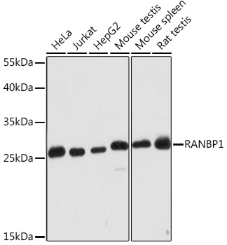 Anti-RANBP1 Antibody (CAB16422)