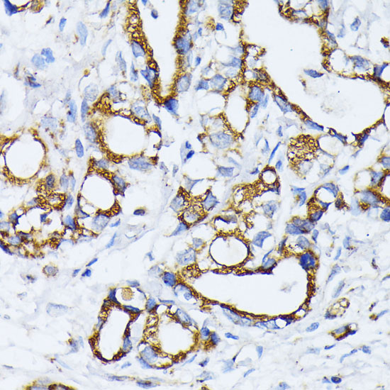 Anti-GOLM1 Antibody (CAB12584)