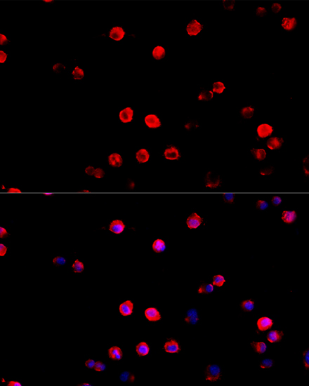 Anti-PD-L1 Antibody (CAB1645)