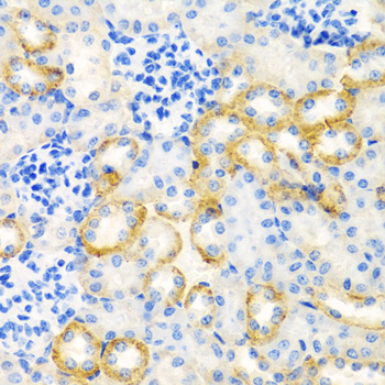 Anti-STC1 Antibody (CAB6755)