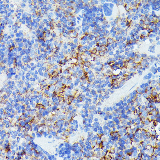 Anti-Iba1 Antibody (CAB12391)