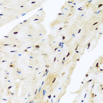 Anti-ZBTB17 Polyclonal Antibody (CAB8463)