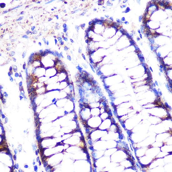 Anti-Caspase-1 Antibody (CAB0964)