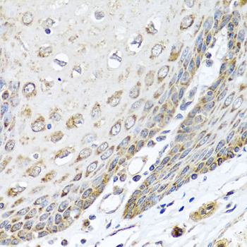 Anti-DEDD Antibody (CAB5806)