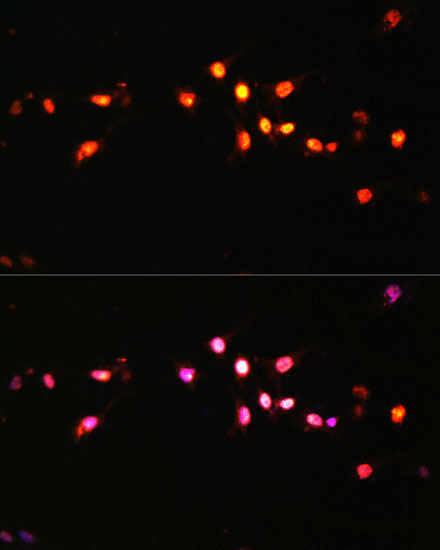 Anti-KDM3A Antibody (CAB11960)