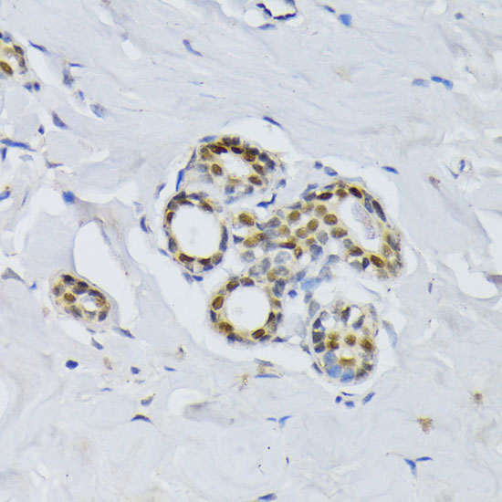 Anti-BCCIP Polyclonal Antibody (CAB8586)