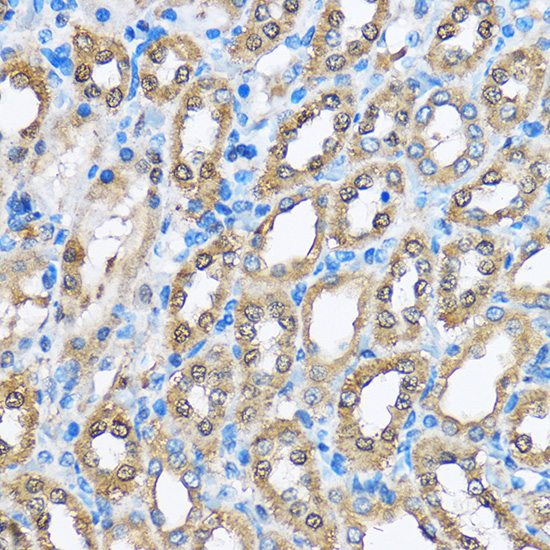 Anti-PHD2 Antibody [KO Validated] (CAB14557)