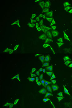 Anti-INPP5J Antibody (CAB6631)