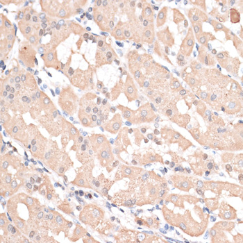 Anti-ABCC5 Antibody (CAB11978)